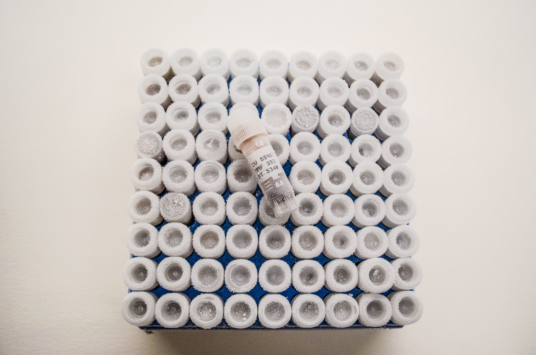 A rack of sample tubes arranged in rows with one tube on top showing the label